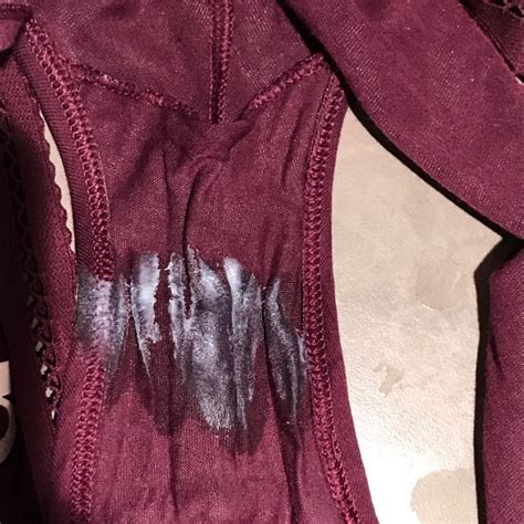 Discharge looks pasty? Is it a possible infection? Also has a slight ...