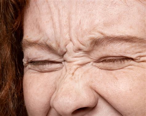 Spierontspanner tegen rimpels - veilige oplossing zonder operatie - Be ...