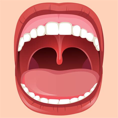 Why Does My Uvula Feel Swollen at Krista Guerrero blog