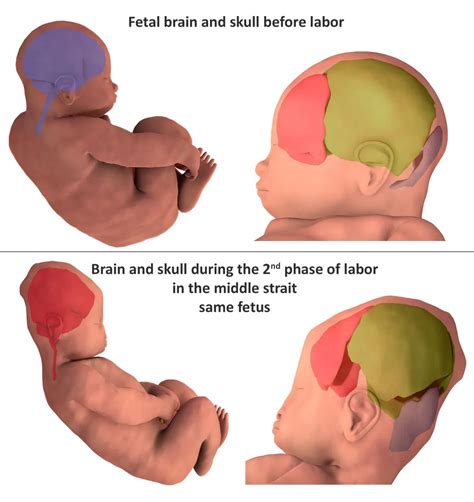 3-D Images Show Just How Much a Baby's Head Changes During Birth