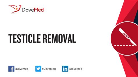 Testicle Removal
