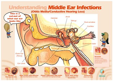 Chronic Ear Infection Lymph Node at Frank Corey blog
