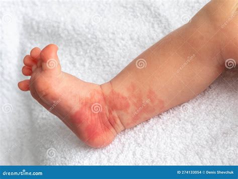 Baby Leg Gloves at Lucy Haire blog