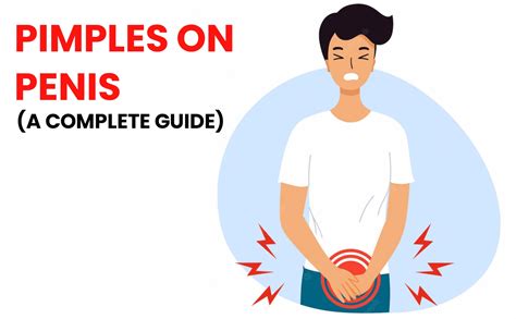 Nuutjob talks about your Intimate hygiene – Tagged "pimples on penis shaft"