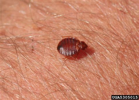 Bed Bug Bites On Eyelid