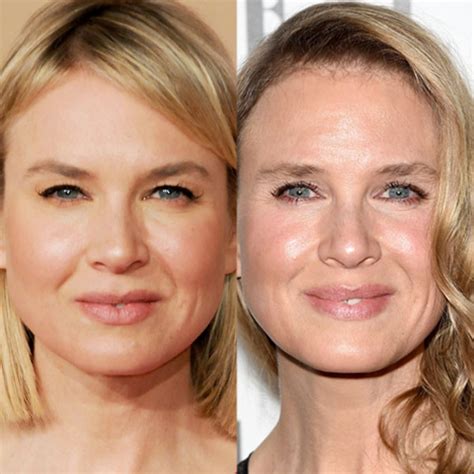 Top 95+ Pictures Renee Zellweger Then And Now Photos Updated