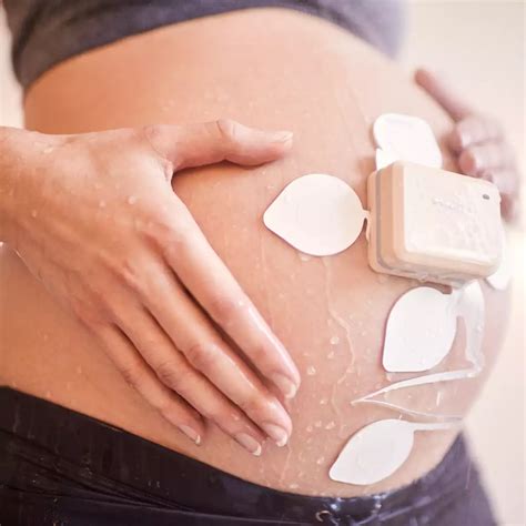 Avalon beltless fetal monitoring solution - Philips