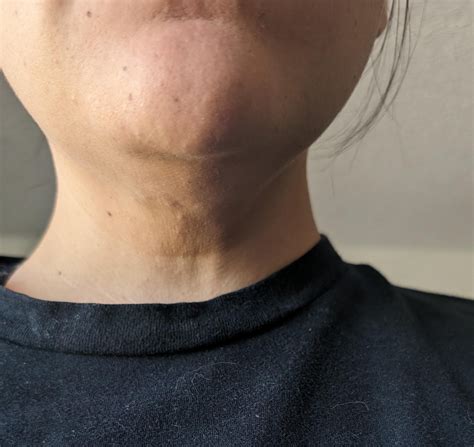 Neck Skin After Weight Loss: Tips For Tightening And Toning | Fitness Tones