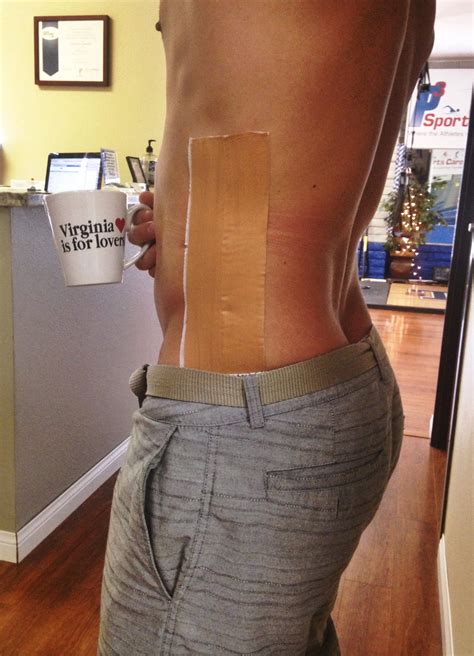 Left Side Abdominal Muscle Strain