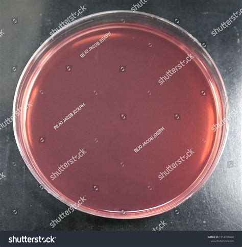 Macconkey Agar Plate
