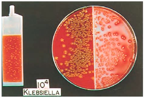 Urine Culture Mixed Gram Positive And Negative Flora at Adela Spooner blog