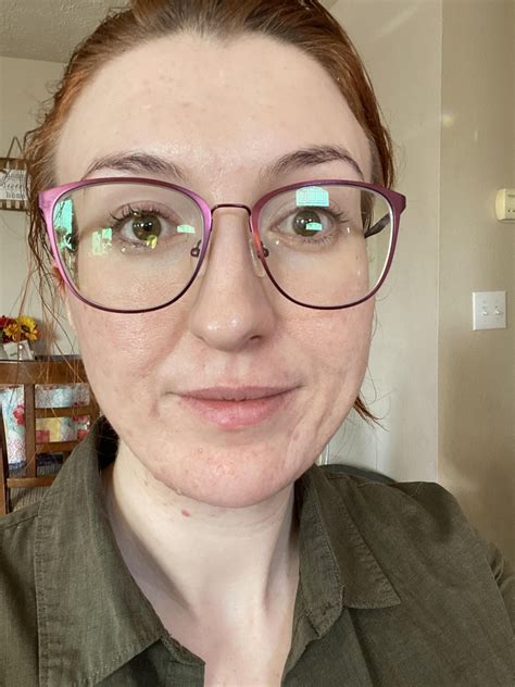 Best procedure to fix my smile, sleep, & dimple wrinkles primarily on the left side of my face ...