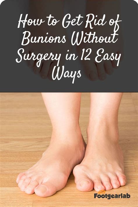 Bunion remedies – Artofit