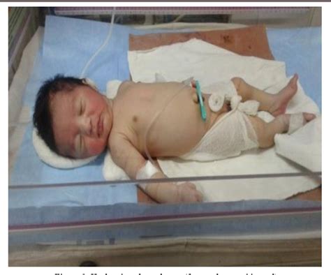 Harlequin Color Change