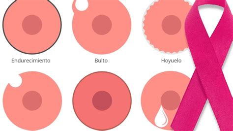 Cáncer de Mama: Testimonios de Guerreras Rosas