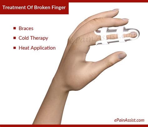 Broken Finger: Treatment, Causes, Symptoms, Signs