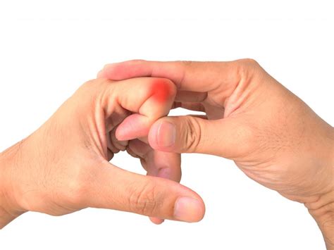 Does Cracking Your Knuckles Cause Arthritis? - Healthcare Associates of ...