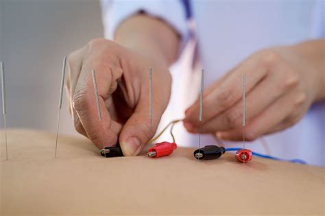 Acupuncture for Neck Pain — Morningside Acupuncture NYC