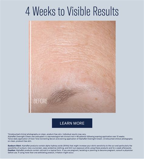 SkinBetter Science: Wake up to Real Results | Milled