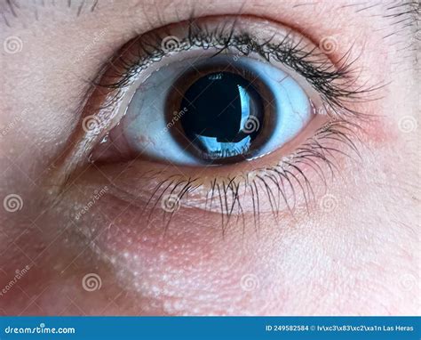 Eye Drops Dilate Pupils at Leo Stonham blog