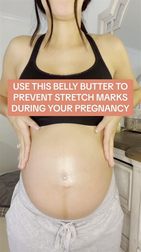 How To Reduce Stretch Marks