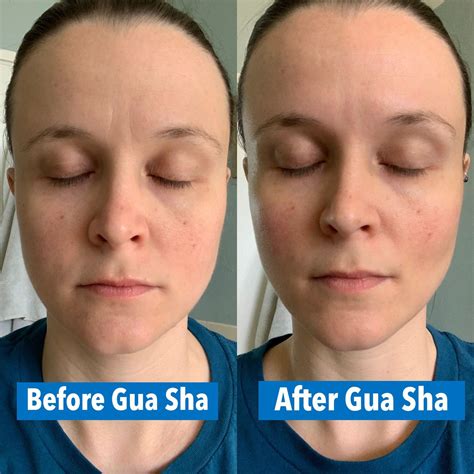 Gua Sha Benefits - BloggBuzz