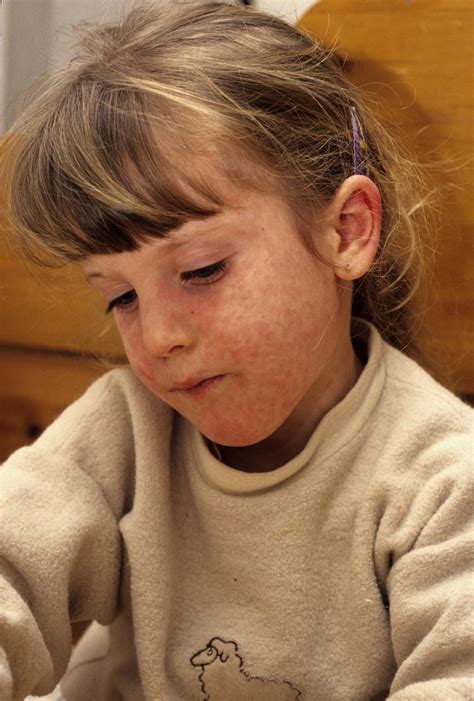 More kids hospitalized with breathing issues, 'very high' fevers as ...