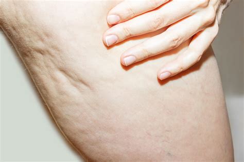 10 Yoga Poses to Improve Lymphatic Drainage Instant Access