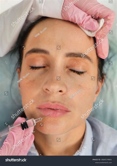 Injecting Lip Filler During Aesthetic Procedure Stock Photo 2604174601 | Shutterstock