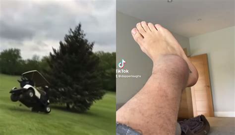 Dapper Laughs Reveals Broken Leg Was Caused By A Golf Buggy Crash ...