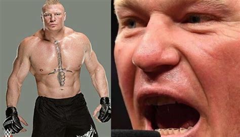 Brock Lesnar has raised curiosity about his teeth among fans!