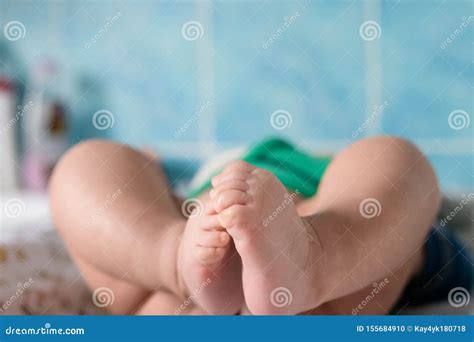 Newborn`s Legs. Close Up Leg Newborn`s Dry Skin, Newborns Often Have ...