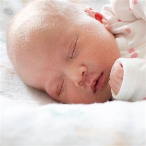 Angel Kiss Birthmark - Spiritual Meaning - Awakening State