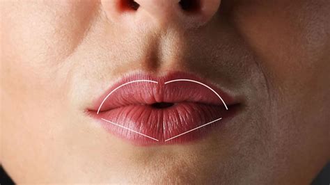 What exactly is the lip flip? - Verve Medical Aesthetics - Facial Aesthetics in Bangor, Belfast ...
