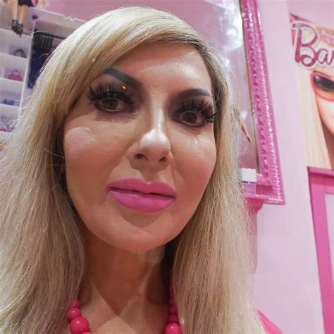 Valeria Lukyonova Real Life Barbie Plastic Surgery 2025