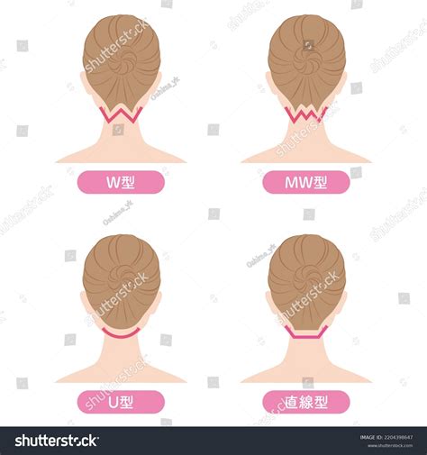 Shape Hair Loss Nape Neck W-shapemw-shape Stock Illustration 2204398647 ...