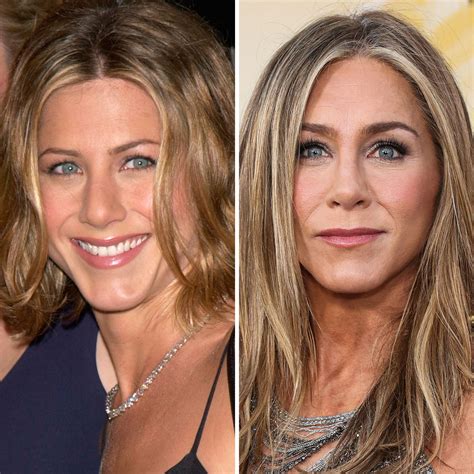 Jennifer Aniston Surgery Face