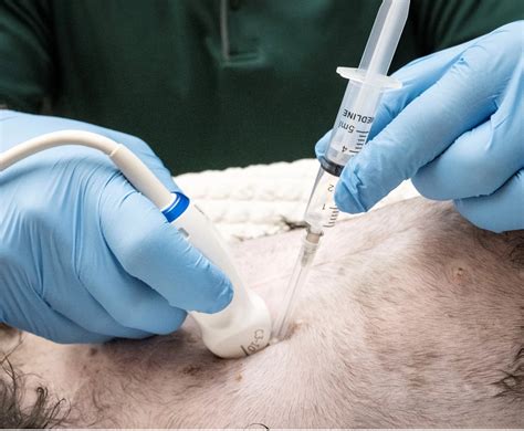 Ultrasound-Guided Fine-Needle Aspiration vs. Nonaspiration