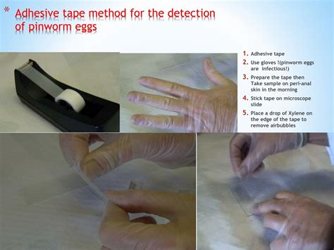 PPT - Staining of Parasites 2 PowerPoint Presentation, free download ...