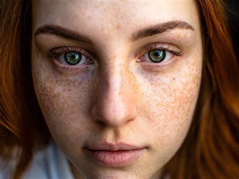 Sunspots On Face Treatment