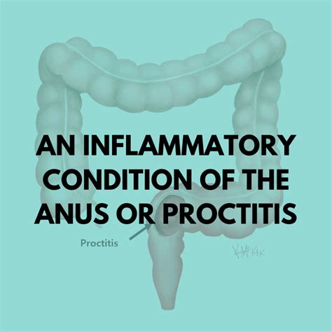 An Inflammatory Condition of the Anus or Proctitis