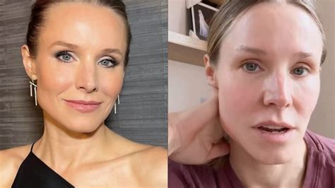 Kristen Bell Nose Job Before And After Analyzing Kristen Bell's Nose: