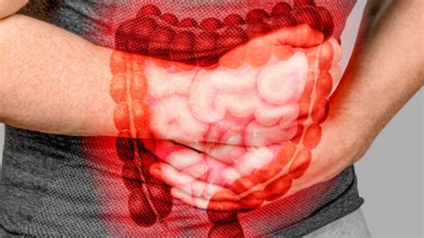 أعراض القولون العصبي وسبل تخفيف شدتها