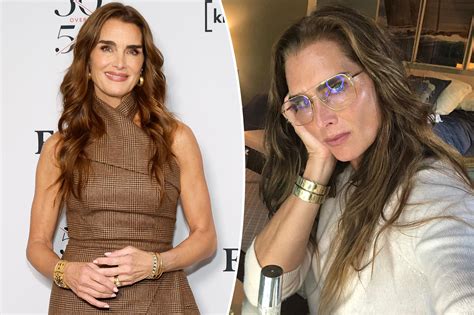 Brooke Shields reveals plastic surgeon threw in ‘little bonus’ during ...