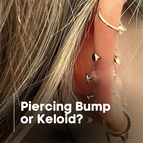 Understanding the Difference Between Piercing Bumps and Keloids – Lulu Ave