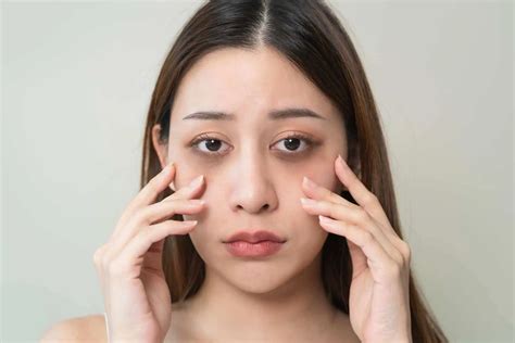 Vitamin K in Skincare: Benefits & How to Use 2026