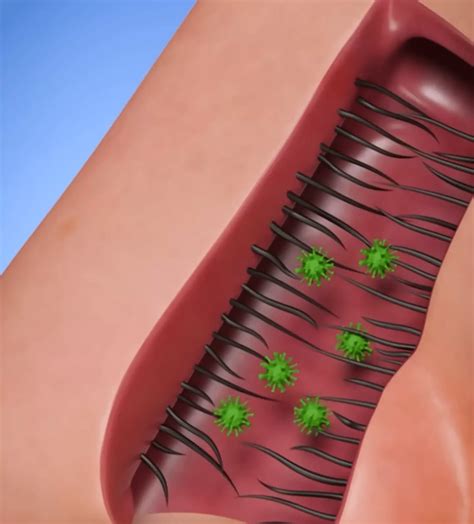 Viral Strange - Why You Shouldn’t Pluck Your Nose Hairs