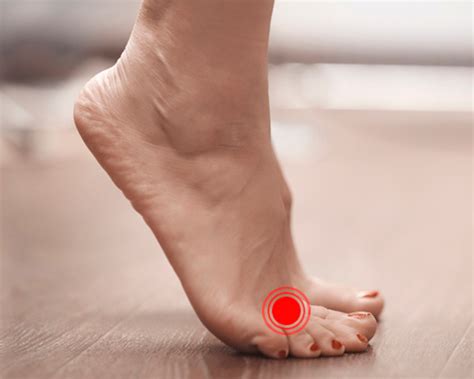 Espolón calcáneo. Causas, síntomas y tratamientos