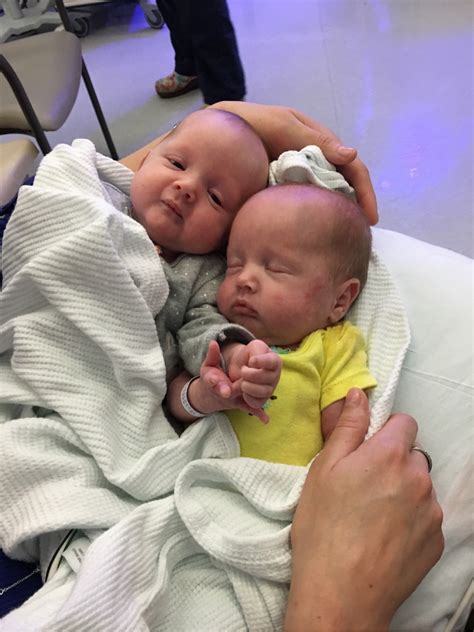 babies born at 37 weeks - Impressed Side