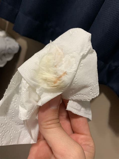 No Discharge After Ovulation Cervical Mucus: A Sign Of Fertility